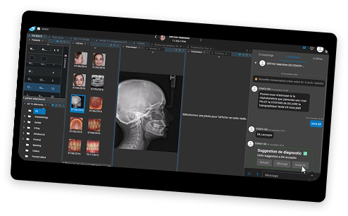 Capture d'écran de l'outil smile monitoring