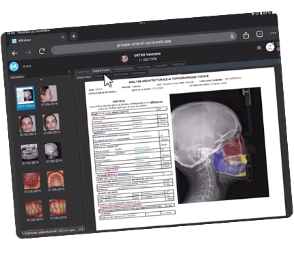 Capture d'écran de l'outil smile monitoring